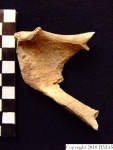 L_V20d5088 A16.31 R827 lR at left pubic symphysis.JPG L_V20d5088 A16.31 R827 lR at left pubic symphysis